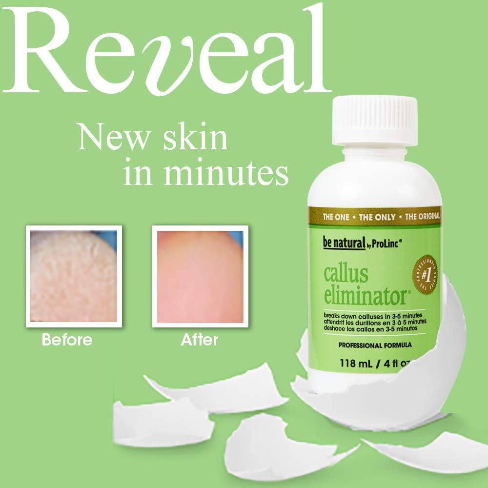 ProLinc Callus Eliminator - 4oz