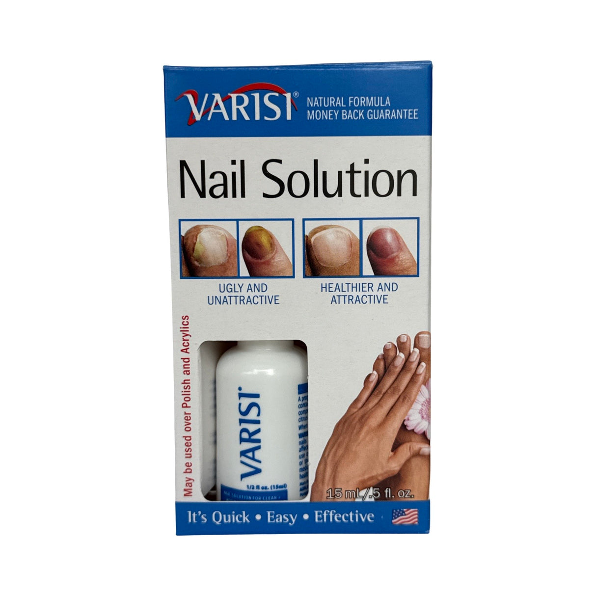 *Box (6pc) Varisi Nail Solution 0.5oz - Anti-Fungal Treatment