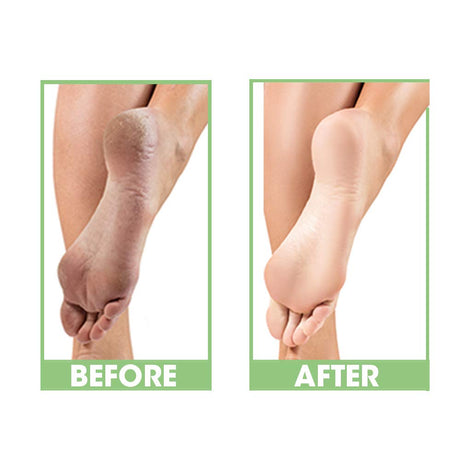ProLinc Dry Heel Eliminator - 4oz