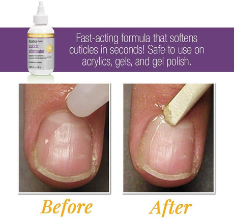 ProLinc Cuticle Eliminator - 4oz