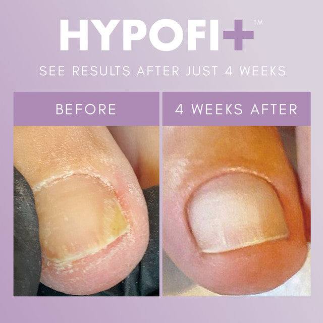 HypoFix™ Repair Serum - 20ml